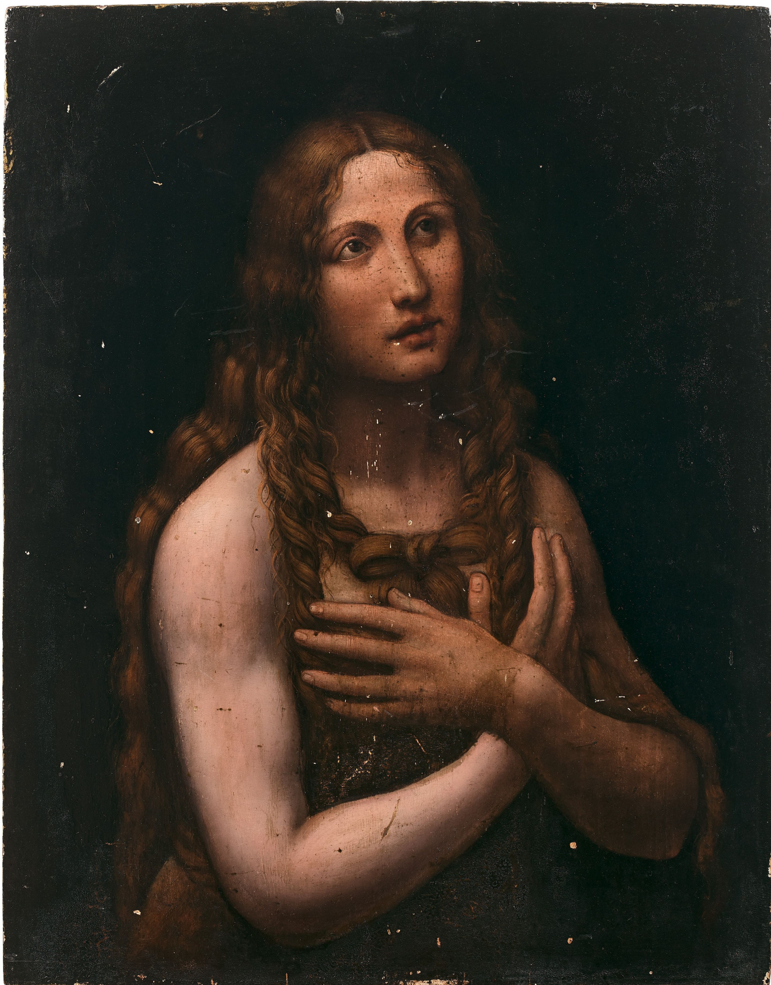 Леонардо да Винчи помог рационализировать операцию при пороке клапана сердца