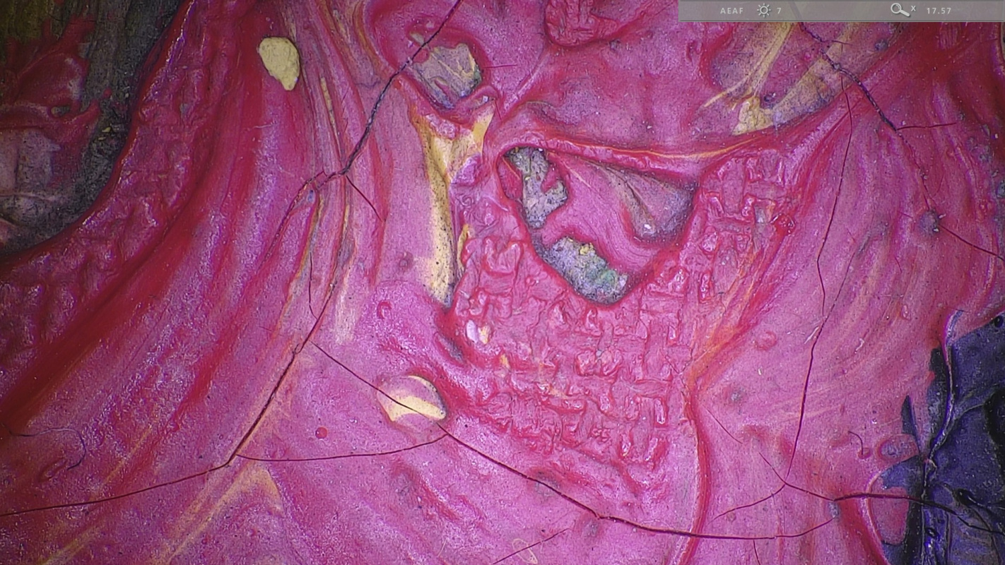 Трещины и отпечаток холста на красочном слое картины "Красные виноградники в Арле". Источник фото
