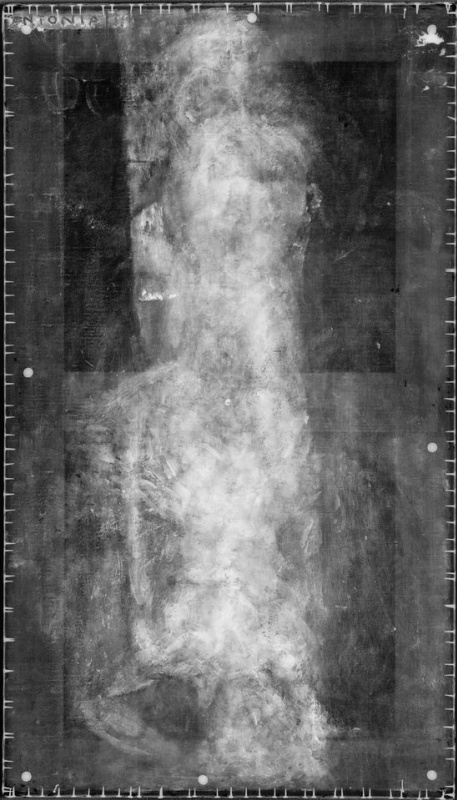 Рентгенография выявила одну или две статуи кариатид с четырьмя руками