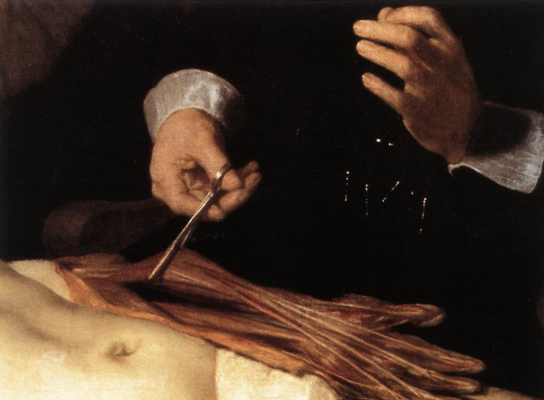 Рембрандт Харменс ван Рейн - Урок анатомии доктора Тульпа, фрагмент, 1632:  Описание произведения | Артхив